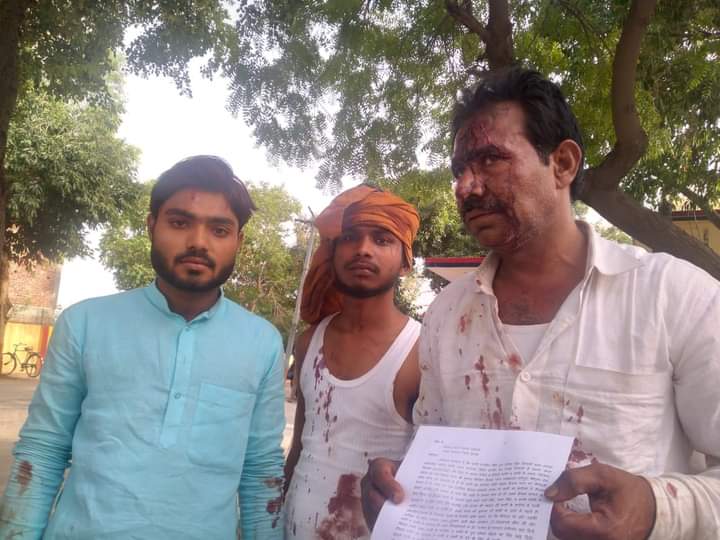 इटावा : पेट्रोल पंप के मैनेजर उनके चाचा सहित तीन लोगों पर हमला