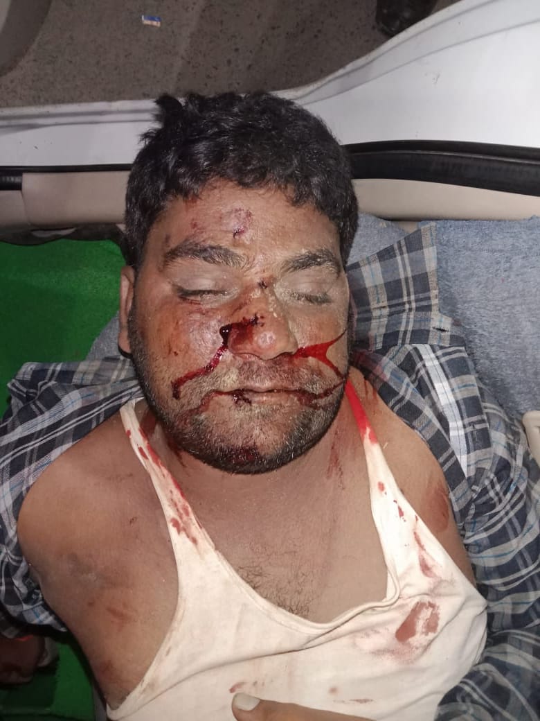 प्रयागराज-थाना खीरी जनपद प्रयागराज के ग्राम पंचायत डीही खुर्द मे पत्रकार ओम प्रकाश की हत्यारों ने की पीट पीट कर हत्या