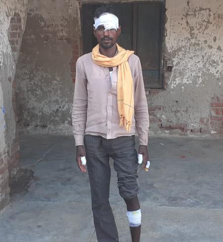 बरेली - जंगली सुअर के हमले से युवक बुरी तरह हुआ घायल।
