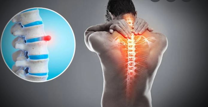 क्या है स्लिप डिस्क की समस्या? जानें क्या हैं कारण और उपचार के विकल्प
