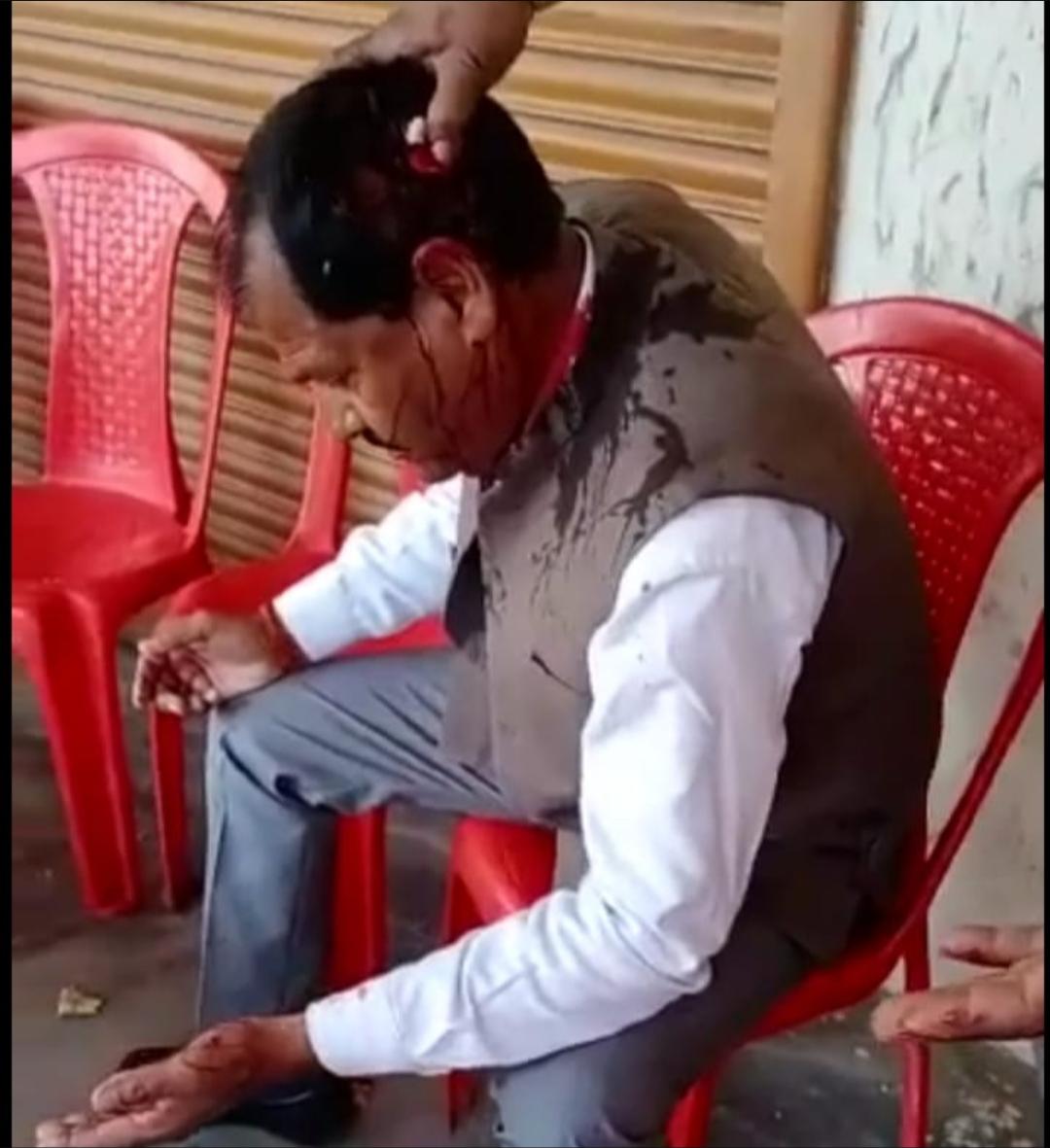 गोण्डा:मतदान के दौरान भाजपा व सपा कार्यकर्ताओं में हुई मारपीट में सपा समर्थक घायल
