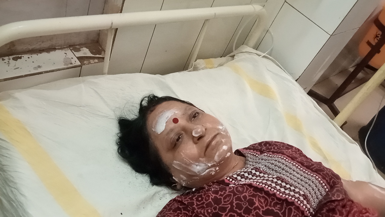 शिवपुरी गणगौर पूजा के दौरान हादसा:दीपक जलाते समय साड़ी में लगी आग, डॉक्टर बोले- 35% तक झुलस गया है शरीर