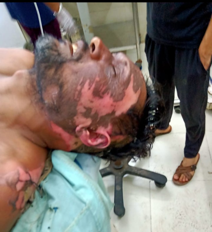 बरेली :फतेहगंज पश्चिमी बिजली विभाग का संविदा कर्मचारी गेंदन लाल झुलसा, बिजली विभाग में मचा हड़कंप, कर्मचारी की हालत गंभीर