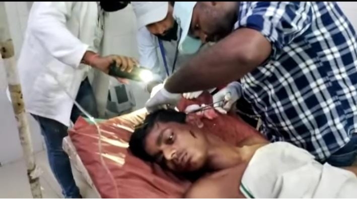 जौनपुर :शाही किले की दीवार गिरने से एक युवक गंभीर रूप से हुआ घायल