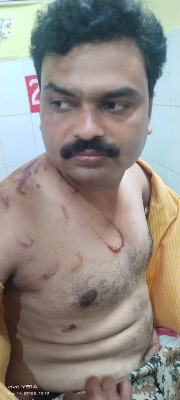 सीतापुर : पत्रकारों पर  हो रहा अत्याचार , चौथा स्तंभ क्यों नहीं सुरक्षित,पत्रकार की बेरहमी से कुछ लोगों ने की पीटा