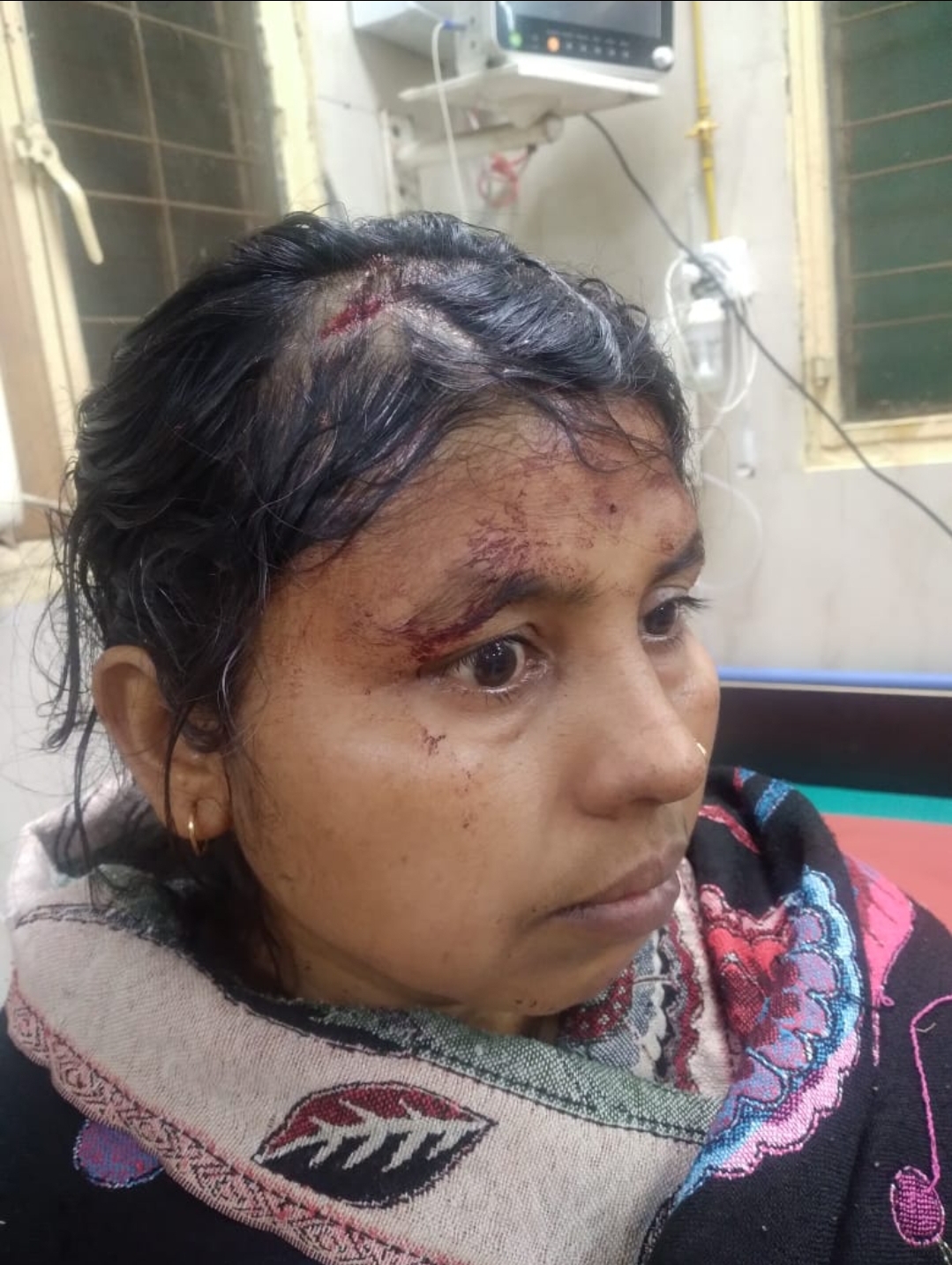 फर्रुखाबाद:पानी भरने को लेकर हुआ विवाद, एक महिला को उसकी जेठानी ने लाठी-डंडों से पीटा