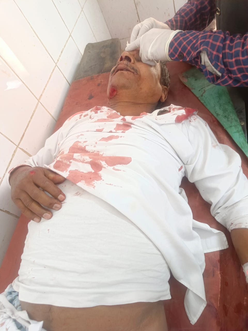 पीलीभीत:-शादी समारोह में जा रहे हैं पिता-पुत्र सहित तीन लोग गंभीर रूप घायल, एक जिला अस्पताल रेफर