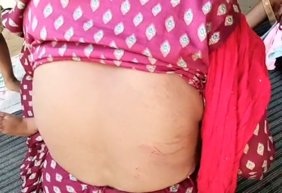 बरेली - सिरौली क्षेत्र में कथा के प्रोग्राम में शराब के नशे में दबंगों ने की महिलाओं के साथ मारपीट कई महिलाएं जख्मी रिपोर्ट दर्ज
