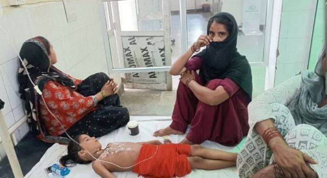 मैनपुरी में मिड के मील में खाना परोसते समय बालिका के ऊपर पलटी गर्म सब्जी से भरी बाल्टी, बुरी तरह झुलसी