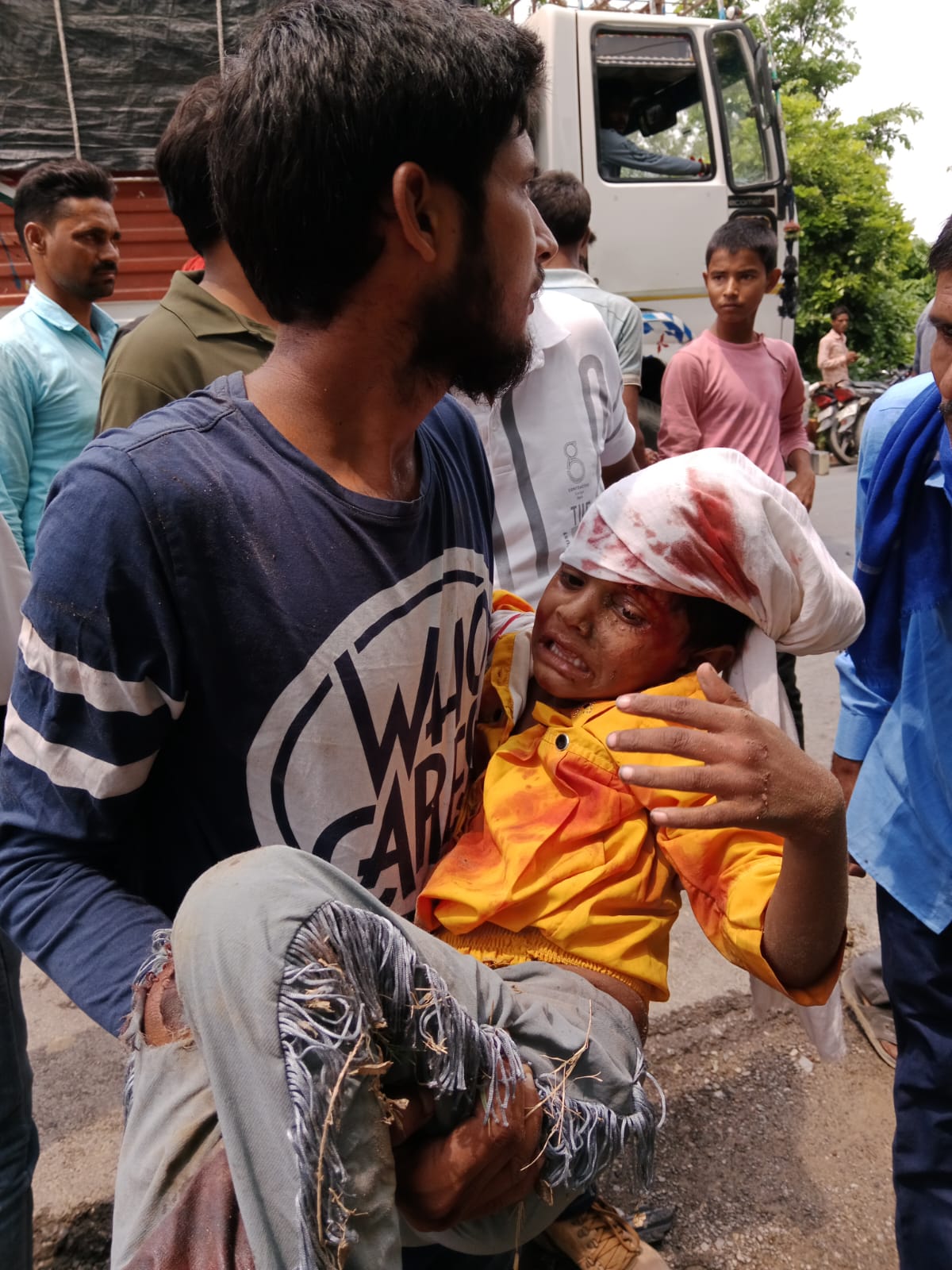 बरेली: हुल्लापुर चौराहा से हरदोई रोड पर दो बाइक सवार की डीसीएम से तेज रफ्तार से टक्कर हो गई