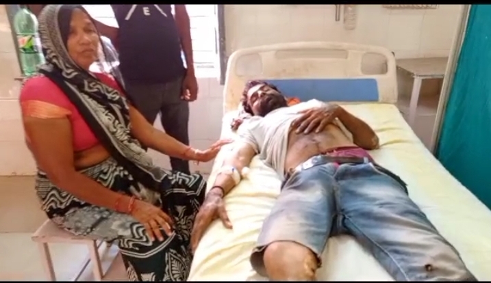 रायबरेली-बिजली विभाग की लापरवाही से लाइन मैन गंभीर रूप से झुलसा जिला अस्पताल में कराया गया भर्ती।