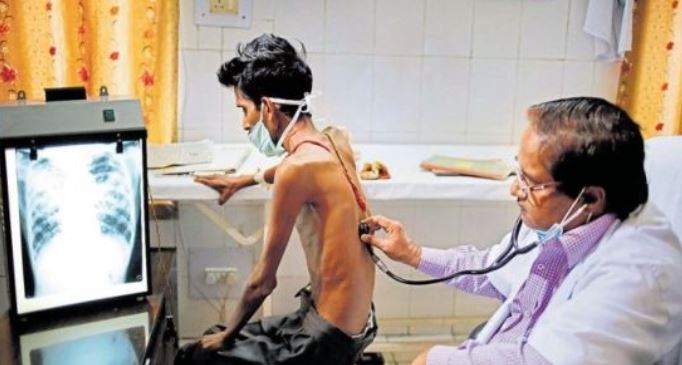 पीलीभीत में घर-घर तलाशे जाएंगे टीबी मरीज
