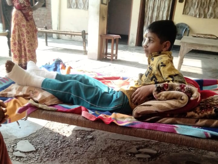 बरेली : मनकरी गांव में बंदरों का आतंक, बच्चा छत से गिरकर हुआ घायल।