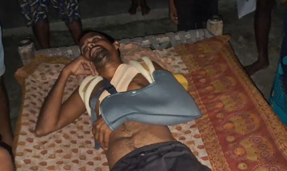 रायबरेली : नहाने के लिए पानी भरने गये युवक बिजली की लपेट मे आने से गंभीर रूप से हुआ घायल ?