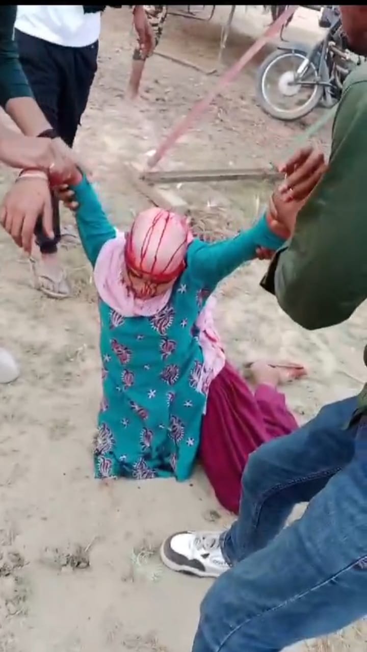 कन्नौज : झूला झूलते समय झूले में फसी चोटी बाल सिर से अलग ?