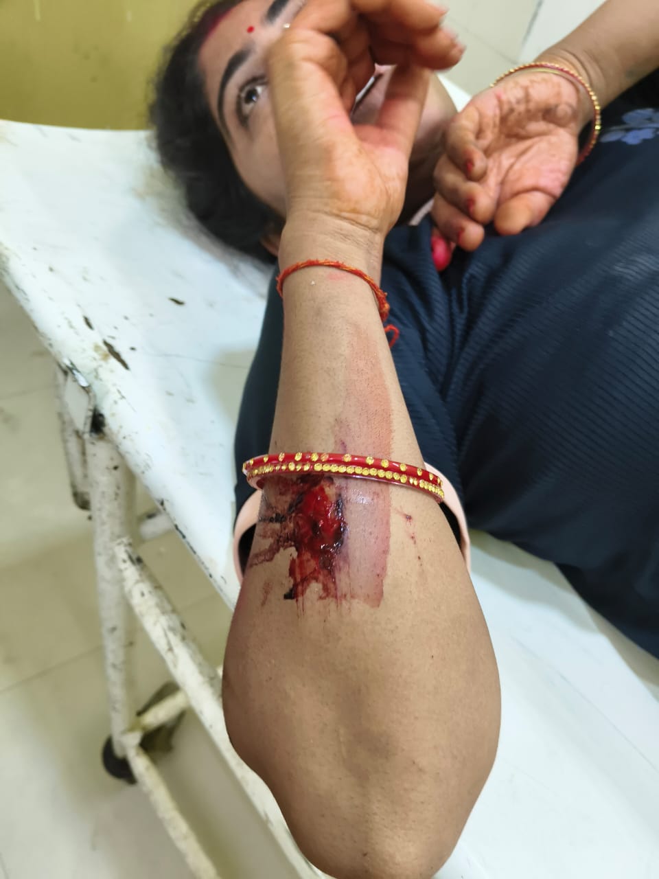 रायबरेली:पुरानी रंजिश को लेकर आधा दर्जन दबंगो ने महिला को दौड़ा दौड़ा कर मारा