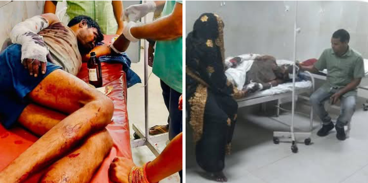लखीमपुर खीरी : तेंदुए ने खूब मचाया तांडव,कई मजदूर व वनकर्मी हुए जख्मी