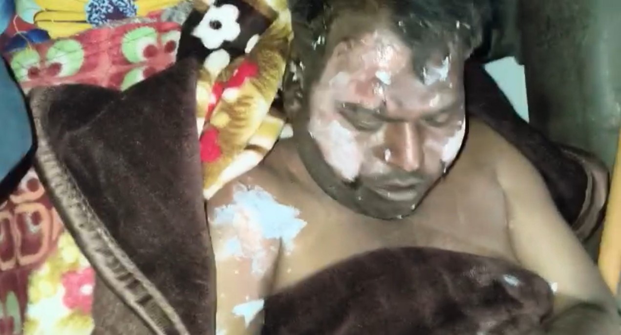 लखीमपुर खीरी : उधार मना करने पर दुकान में लगाई आग,व्यापारी बुरी तरह झुलसा