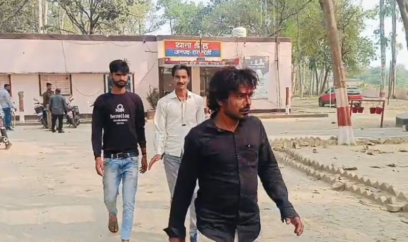 रायबरेली : युवक पर रॉड से हमला:दो पर मारपीट का आरोप, पुलिस जांच में जुटी
